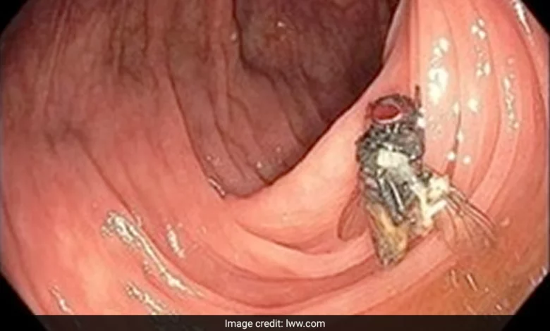 a fly in the colon